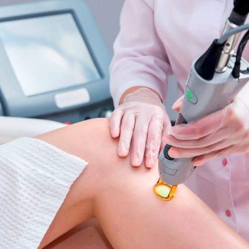 Prepare your skin for laser hair Removal